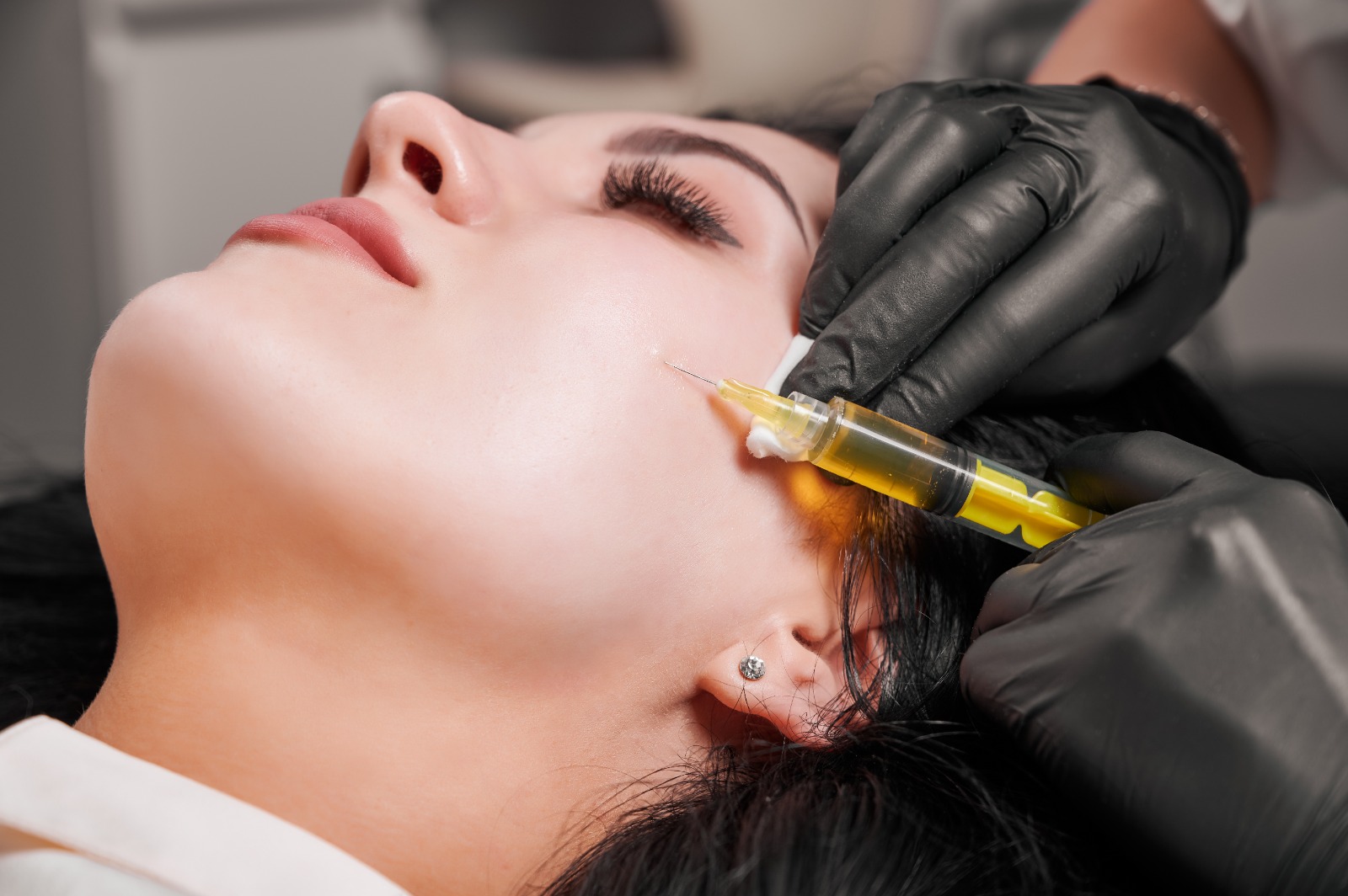 PRP Therapy